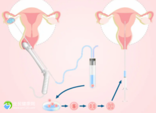 2CC囊胚成功的可能性大不大？