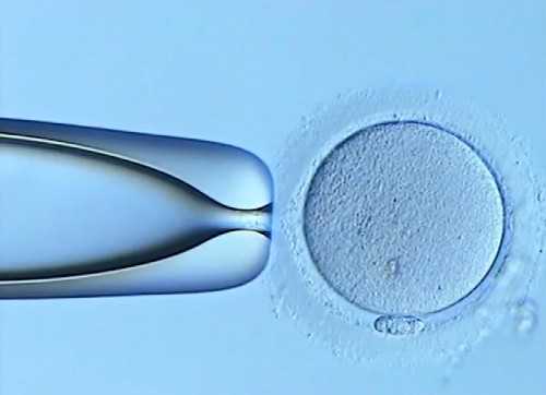 试管婴儿费用能否医保报销？解析辅助生殖补贴政策与费用构成