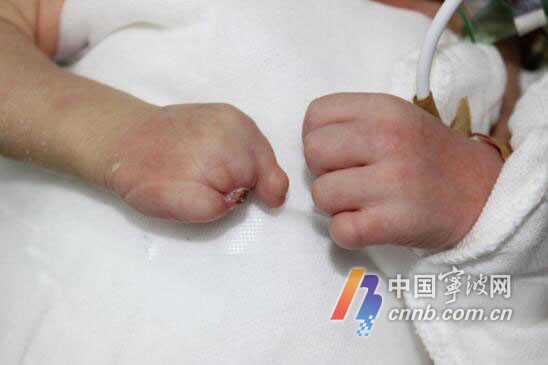 湖北供卵_中国大陆第一例“试管婴儿”，如今现状如何？答案或许令你生疑
