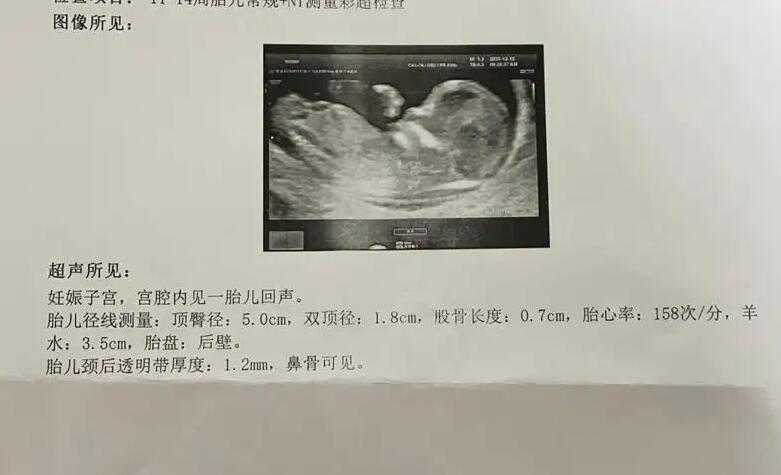 哈尔滨代孕最新法律规定_介绍哈尔滨世纪代孕供卵试管中心-哈尔滨有代孕的吗
